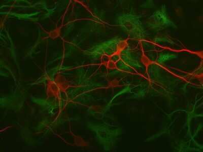 Immunocytochemistry/ Immunofluorescence: GFAP Antibody - Azide and BSA Free [NB110-93480]