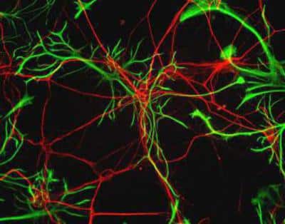 Immunocytochemistry/ Immunofluorescence: GFAP Antibody [NB300-141]