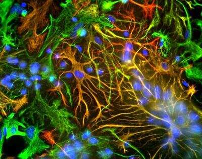 Immunocytochemistry/ Immunofluorescence: GFAP Antibody [NB300-141]