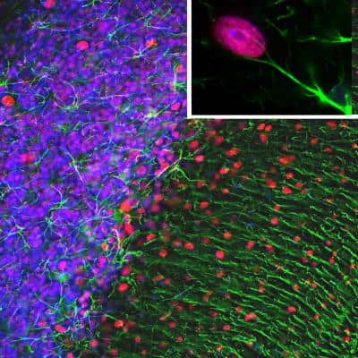 Immunohistochemistry: GFAP Antibody [NB300-141]
