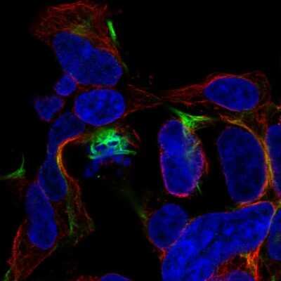 Immunocytochemistry/ Immunofluorescence: GFAP Antibody [NBP2-33774]