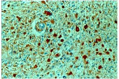 Immunohistochemistry-Paraffin: GFAP Antibody [NB120-16997]