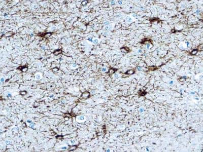 Immunohistochemistry-Paraffin: GFAP Antibody [NB120-16997]
