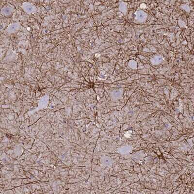Immunohistochemistry-Paraffin: GFAP Antibody [NBP2-33774]