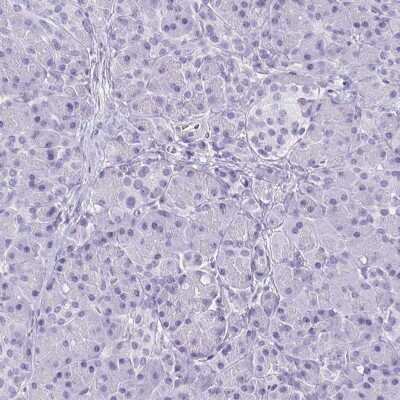 Immunohistochemistry-Paraffin: GFAP Antibody [NBP2-33774]