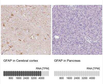 Immunohistochemistry-Paraffin: GFAP Antibody [NBP2-54748]