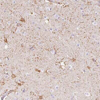 Immunohistochemistry-Paraffin: GFAP Antibody [NBP2-54748]