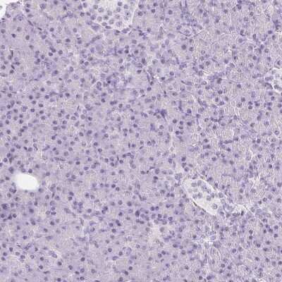 Immunohistochemistry-Paraffin: GFAP Antibody [NBP2-54748]