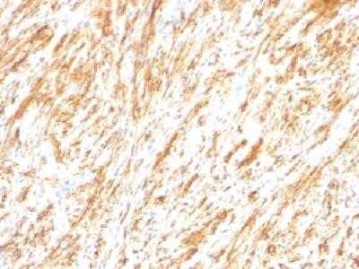 Immunohistochemistry-Paraffin: GFAP Antibody (SPM248) - Azide and BSA Free [NBP2-34401]