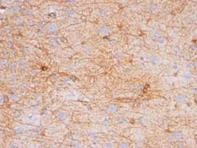 Immunohistochemistry-Paraffin: GFAP Antibody (SPM507) [NBP2-34365]