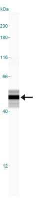 Simple Western: GFAP Antibody [NB300-141]