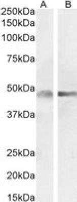 Western Blot: GFAP Antibody [NB100-53809]
