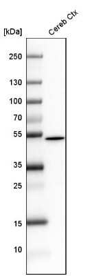 Western Blot: GFAP Antibody [NBP2-33774]
