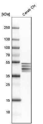Western Blot: GFAP Antibody [NBP2-33774]