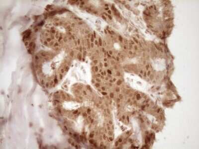 Immunohistochemistry: GFI-1 Antibody (OTI6E8) [NBP2-45833]