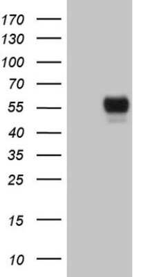Western Blot: GFI-1 Antibody (OTI6E8) [NBP2-45833]