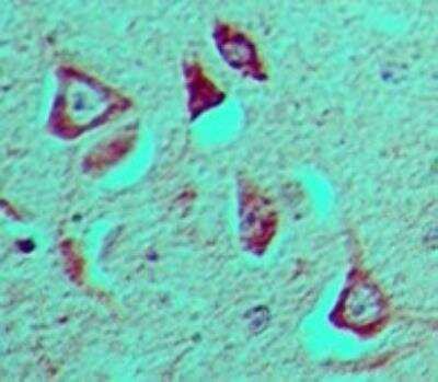 Immunohistochemistry-Paraffin: GFI-1 Antibody [NBP2-27173]