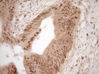 Immunohistochemistry: GFI-1 Antibody (OTI6E8) - Azide and BSA Free [NBP2-70827]