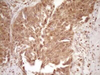 Immunohistochemistry: GFI-1 Antibody (OTI6E8) - Azide and BSA Free [NBP2-70827]