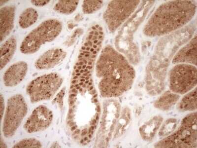 Immunohistochemistry: GFI-1 Antibody (OTI6E8) - Azide and BSA Free [NBP2-70827]