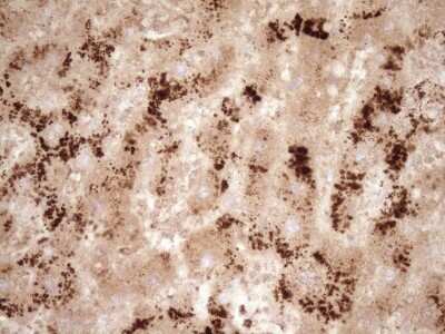 Immunohistochemistry: GFI-1 Antibody (OTI6E8) - Azide and BSA Free [NBP2-70827]