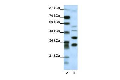 Western Blot: GFI-1 Antibody [NBP2-82227]