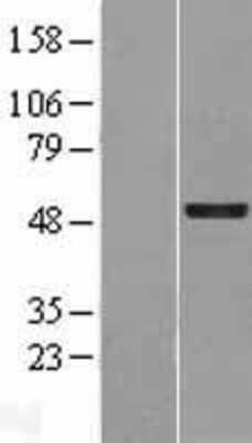 Western Blot: GFI-1 Overexpression Lysate [NBP2-09431]