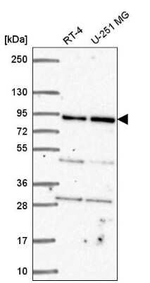 Western Blot: GFM1 Antibody [NBP2-55712]