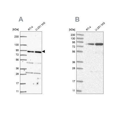 Western Blot: GFM1 Antibody [NBP2-55712]