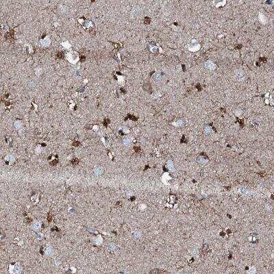 Immunohistochemistry: GFOD2 Antibody [NBP1-82067]