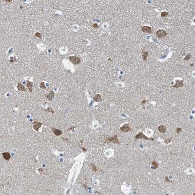 Immunohistochemistry-Paraffin: GFOD2 Antibody [NBP1-82066]
