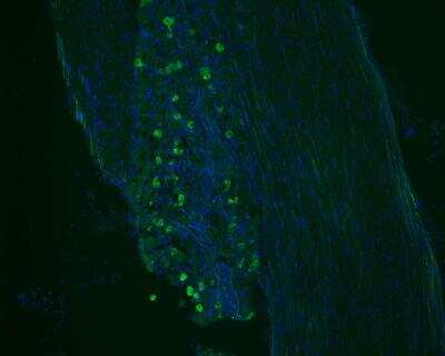 Immunocytochemistry/ Immunofluorescence: GFP Antibody [NB100-1614]