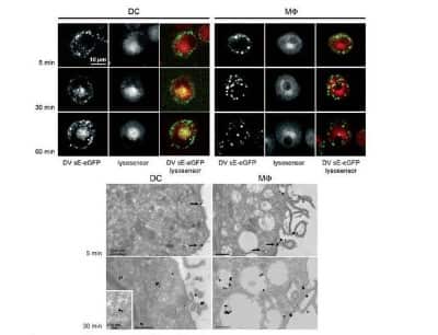 Immunocytochemistry/Immunofluorescence Imaging of GFP Labeled Dengue Virus in Dendritic Cells and Dermal Macrophages