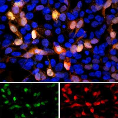 Immunocytochemistry/ Immunofluorescence: GFP Antibody [NBP2-50059]