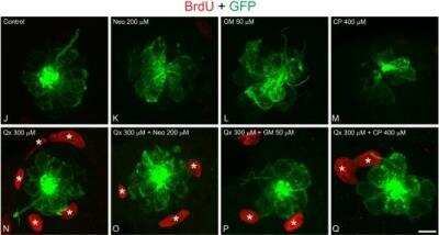 Immunohistochemistry: GFP Antibody [NB100-1614]