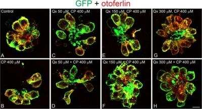 Immunohistochemistry: GFP Antibody [NB100-1614]