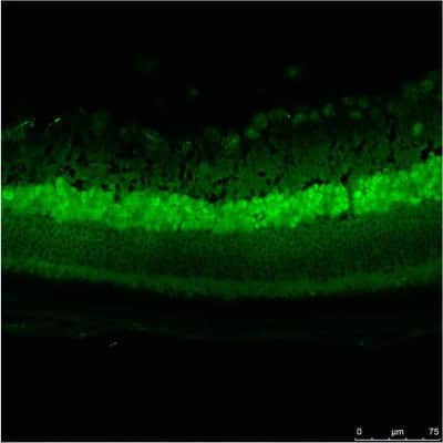 Immunohistochemical Staining of GFP in Mouse Retinal Cells