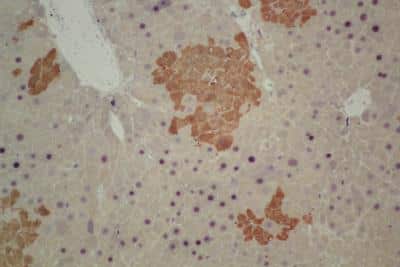Immunohistochemical Staining of GFP+ Hepatocytes in Paraffin Embedded Liver