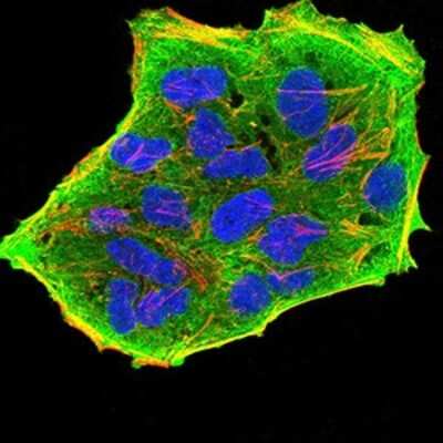 Immunocytochemistry/ Immunofluorescence: GFPT1 Antibody (1F1A4) - BSA Free [NBP2-52472]