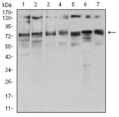 Western Blot: GFPT1 Antibody (1F1A4)BSA Free [NBP2-52472]