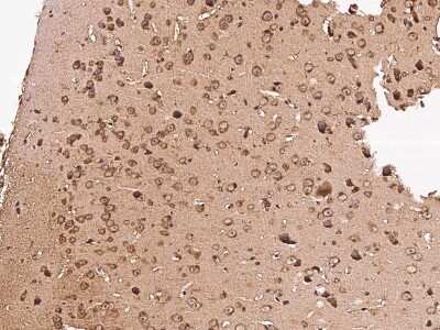 Immunohistochemistry-Paraffin: GFR alpha-1/GDNF R alpha-1 Antibody (009) [NBP2-90463]