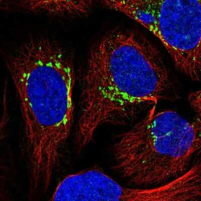 Immunocytochemistry/ Immunofluorescence: GFR alpha-1/GDNF R alpha-1 Antibody [NBP2-14045]