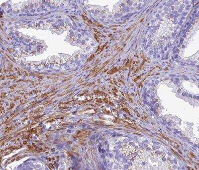 Immunohistochemistry-Paraffin: GFR alpha-1/GDNF R alpha-1 Antibody [NBP2-14045]