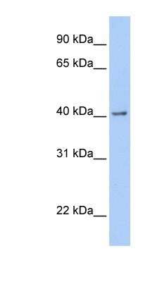 Western Blot: GFR alpha-2/GDNF R alpha-2 Antibody [NBP1-79553]