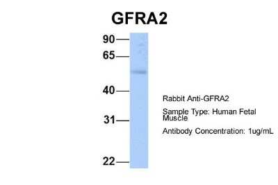 Western Blot: GFR alpha-2/GDNF R alpha-2 Antibody [NBP1-79553]