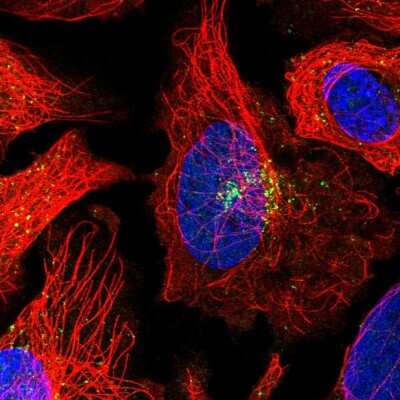 Immunocytochemistry/ Immunofluorescence: GGA1 Antibody [NBP2-14047]