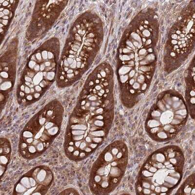 Immunohistochemistry-Paraffin: GGA1 Antibody [NBP2-14047]