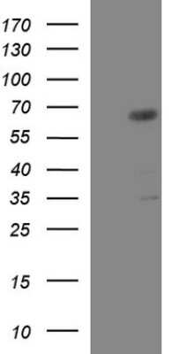 Western Blot: GGA2 Antibody (OTI1D2) [NBP2-45853]