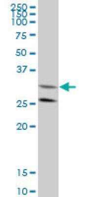Western Blot: GGPS1 Antibody (1C3) [H00009453-M08]