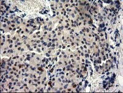 Immunohistochemistry: GGPS1 Antibody (OTI3F9) - Azide and BSA Free [NBP2-71463]